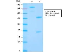 SDS-PAGE Analysis Purified RCC Rabbit Recombinant Monoclonal Antibody (CA9/2993R).