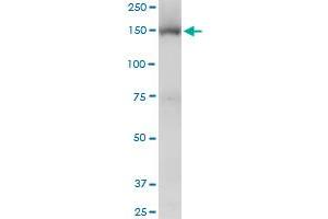 Viral Entry Inhibition (VEI) image for anti-Tripartite Motif Containing 33 (TRIM33) (AA 1006-1106) antibody (ABIN599250) (TRIM33 anticorps  (AA 1006-1106))