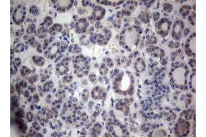 Image no. 2 for anti-Paternally Expressed 3 (PEG3) (AA 1-364) antibody (ABIN1490765)