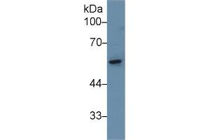 Detection of CAP1 in Rat Small intestine lysate using Polyclonal Antibody to Adenylyl Cyclase Associated Protein 1 (CAP1)