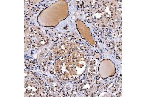 IHC analysis of SMARCA2/BRM using anti-SMARCA2/BRM antibody (ABIN7601969).