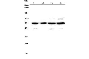 Western blot analysis of CCNB2 using anti-CCNB2 antibody (ABIN7600750).