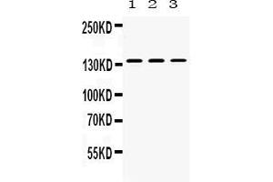 Western blot analysis of Nephrin expression in rat kidney extract ( Lane 1), mouse kidney extract ( Lane 2) and 293T whole cell lysates ( Lane 3). (Nephrin anticorps  (AA 1084-1241))