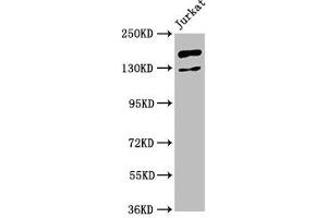 Western Blot Positive WB detected in: Jurkat whole cell lysate All lanes: CASZ1 antibody at 4. (CASZ1 anticorps  (AA 127-266))