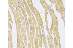 Immunohistochemistry of paraffin-embedded Mouse heart using CSRP3 Polyclonal Antibody at dilution of 1:100 (40x lens). (CSRP3 anticorps)