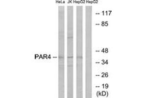 Western blot analysis of extracts from HepG2/Jurkat/HeLa cells, using PAR4 Antibody. (F2RL3 anticorps  (AA 29-78))
