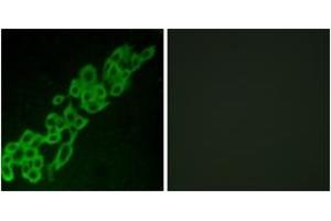 Immunofluorescence analysis of A549 cells, using GPR32 Antibody. (GPR32 anticorps  (AA 151-200))