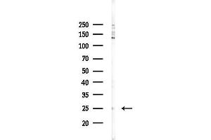 Western blot analysis of lysates from 293 cells(LPS,4h treatment), using CMTM4 Antibody at 1/1000 dilution.