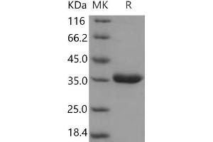 Western Blotting (WB) image for Protease, serine, 8 (PRSS8) (AA 30-289) protein (His tag) (ABIN7197548)
