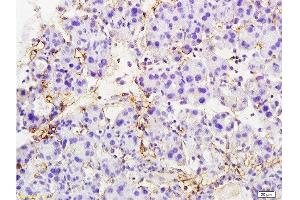 Formalin-fixed and paraffin embedded rat pancreas tissue labeled with Anti-MTUS1 Polyclonal Antibody, Unconjugated  at 1:200 followed by conjugation to the secondary antibody and DAB staining