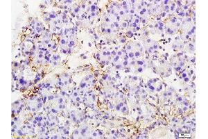 Formalin-fixed and paraffin embedded rat pancreas tissue labeled with Anti-MTUS1 Polyclonal Antibody, Unconjugated  at 1:200 followed by conjugation to the secondary antibody and DAB staining (MTUS1 anticorps  (AA 1151-1270))