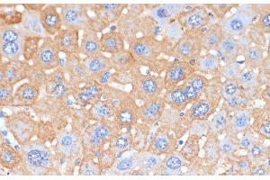 Immunohistochemistry of paraffin-embedded Mouse liver using APCS Polyclonal Antibody at dilution of 1:100 (40x lens).
