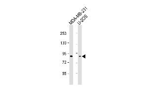 All lanes : Anti-SMURF2 Antibody at 1:2000-1:4000 dilution Lane 1: MDA-MB-231 whole cell lysate Lane 2: U-2OS whole cell lysate Lysates/proteins at 20 μg per lane. (SMURF2 anticorps)