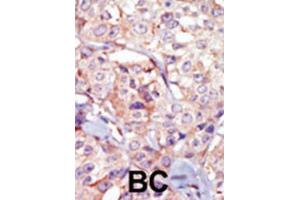 Immunohistochemistry (IHC) image for anti-Germ Cell Associated 2 (Haspin) (GSG2) antibody (ABIN3003656) (GSG2 anticorps)