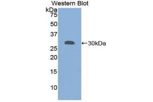 Western Blotting (WB) image for anti-Granulin (GRN) (AA 361-585) antibody (ABIN1859075) (Granulin anticorps  (AA 361-585))