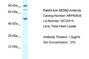 Western Blotting (WB) image for anti-Sestrin 2 (SESN2) (C-Term) antibody (ABIN786225) (Sestrin 2 anticorps  (C-Term))