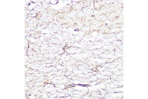 Immunohistochemistry of paraffin-embedded human brain using GFAP Rabbit pAb (ABIN3020750, ABIN3020751, ABIN3020752, ABIN1512943 and ABIN6213705) at dilution of 1:100 (40x lens).