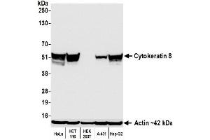 Western Blotting (WB) image for anti-Keratin 8 (KRT8) (C-Term) antibody (ABIN7795705)