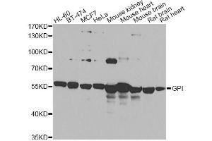 Western blot analysis of extracts of various cell lines, using GPI antibody (ABIN6292114) at 1:1000 dilution. (GPI anticorps)
