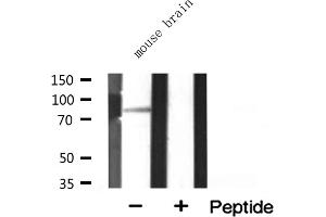 Western blot analysis of extracts from mouse brain, using MARK3 antibody. (MARK3 anticorps  (N-Term))