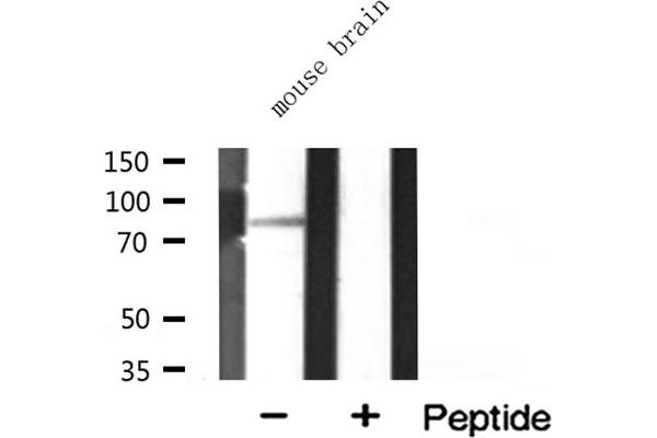 MARK3 anticorps  (N-Term)
