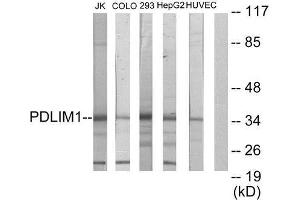 Western Blotting (WB) image for anti-PDZ and LIM Domain 1 (PDLIM1) (Internal Region) antibody (ABIN1848911) (PDLIM1 anticorps  (Internal Region))