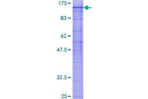 Image no. 1 for Proprotein Convertase Subtilisin/kexin Type 7 (PCSK7) (AA 1-785) protein (GST tag) (ABIN1314365)