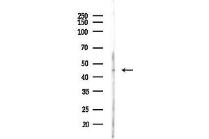 anti-Adiponectin Receptor 1 (ADIPOR1) (C-Term) antibody