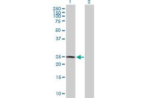 Western Blot analysis of RNF114 expression in transfected 293T cell line by RNF114 MaxPab polyclonal antibody. (RNF114 anticorps  (AA 1-228))
