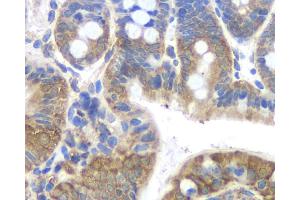 Immunohistochemistry analysis of paraffin-embedded mouse colon using FAS Monoclonal Antibody at dilution of 1:200. (FAS anticorps)