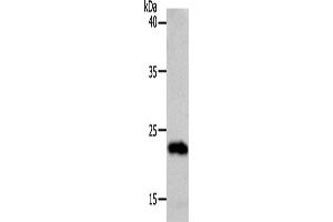 Western Blotting (WB) image for anti-Suppressor of Cytokine Signaling 1 (SOCS1) antibody (ABIN2426412) (SOCS1 anticorps)