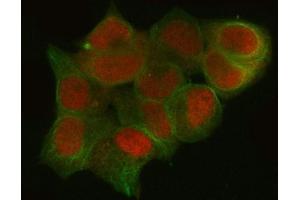 IF analysis of CTBP1 using anti-CTBP1 antibody (ABIN3043816) and anti-Tubulin Alpha antibody (ABIN7600339). (CTBP1 anticorps  (C-Term))