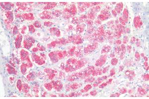 (ABIN768541) (5 μg/mL) staining of paraffin embedded Human Adrenal Gland. (CD56 anticorps  (Internal Region))