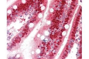 Human Small Intestine: Formalin-Fixed, Paraffin-Embedded (FFPE).