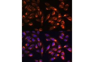 Immunofluorescence analysis of U-2 OS cells using PTCD1 antibody (ABIN7269203) at dilution of 1:100. (PTCD1 anticorps  (AA 435-537))