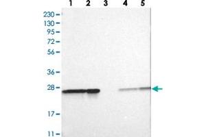 Western blot analysis of Lane 1: RT-4, Lane 2: U-251 MG, Lane 3: Human Plasma, Lane 4: Liver, Lane 5: Tonsil with PSMA2 polyclonal antibody . (PSMA2 anticorps)
