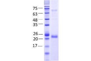 Emopamil Binding Protein (Sterol Isomerase) (EBP) AA 2- 230), fraction 12 - 13 (EBP Protein (AA 2-230) (rho-1D4 tag))
