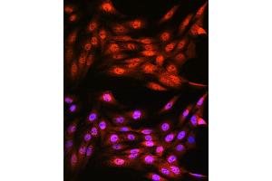 Immunofluorescence analysis of C6 cells using VCP Rabbit mAb (ABIN7271284) at dilution of 1:100 (40x lens).
