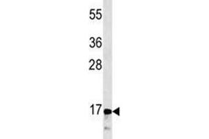 CGRP antibody western blot analysis in CEM lysate