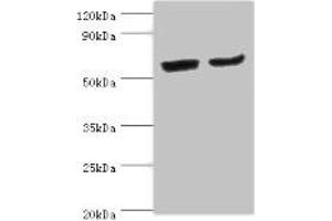 Western blot All lanes: CYP2J2 antibody at 4 μg/mL Lane 1: Mouse skeletal muscle tissue Lane 2: Rat liver tissue Secondary Goat polyclonal to rabbit IgG at 1/10000 dilution Predicted band size: 58 kDa Observed band size: 58 kDa