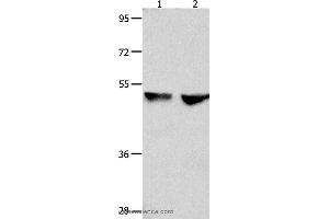 Western blot analysis of 823 and Hela cell , using CDK9 Polyclonal Antibody at dilution of 1:300 (CDK9 anticorps)