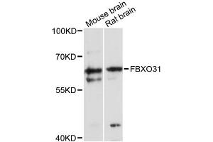 Western blot analysis of extracts of various cell lines, using FBXO31 antibody (ABIN6291619) at 1:3000 dilution. (FBXO31 anticorps)
