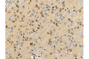 ABIN6258311 and ABIN6274239 at 1/100 staining Rat brain tissue by IHC-P.