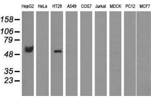 Western blot analysis of extracts (35 µg) from 9 different cell lines by using anti-CORO1B monoclonal antibody. (CORO1B anticorps)