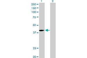 Western Blot analysis of MAGEA9 expression in transfected 293T cell line by MAGEA9 MaxPab polyclonal antibody.
