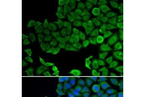 Immunofluorescence analysis of A549 cells using VPS4A Polyclonal Antibody (VPS4A anticorps)