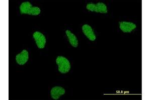 Immunofluorescence of monoclonal antibody to PPARBP on HeLa cell. (MED1 anticorps  (AA 1391-1490))