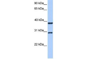 WB Suggested Anti-KLHDC1 Antibody Titration: 0. (KLHDC1 anticorps  (N-Term))