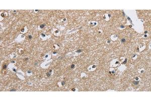 Immunohistochemistry of paraffin-embedded Human brain using CAB39L Polyclonal Antibody at dilution of 1:40 (CAB39L anticorps)