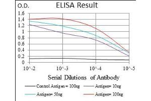 Black line: Control Antigen (100 ng), Purple line: Antigen(10 ng), Blue line: Antigen (50 ng), Red line: Antigen (100 ng),